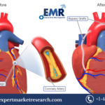 Coronary Artery Bypass Graft Procedures Market
