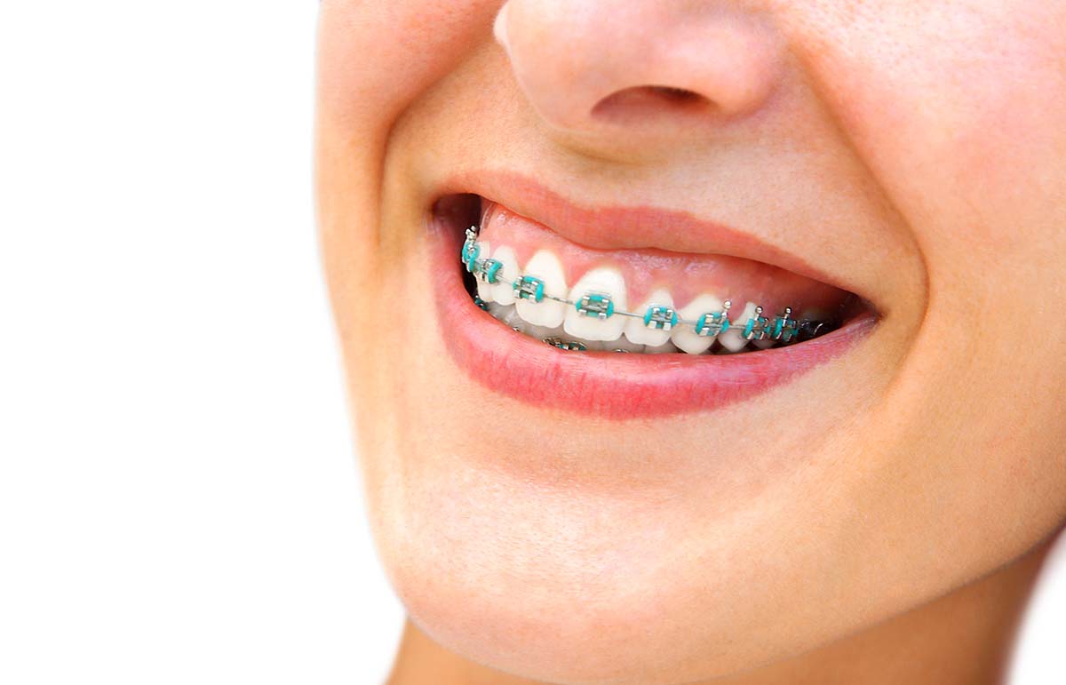 Orthodontist in Aventura, Florida: Transforming Smiles with Precision and Care