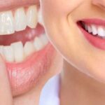 dental emergencies Houston